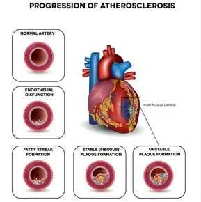 Protocol terapeutic integrat pentru reducerea homocisteinei și protecția cardiovasculară