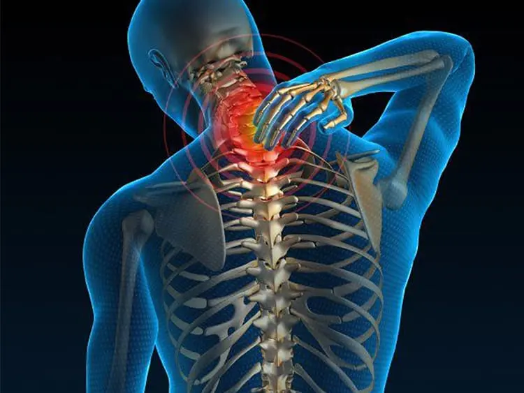 Spondiloza cervicală – cauze, simptome și opțiuni moderne de tratament